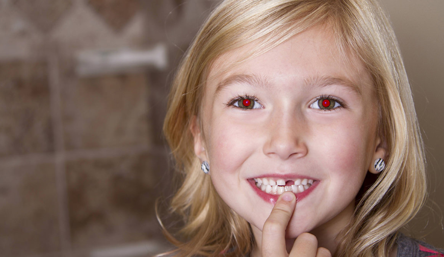 Occhi rossi nelle foto