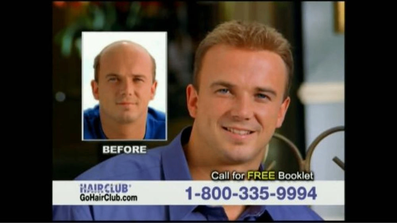 HairClub for Men infomercial