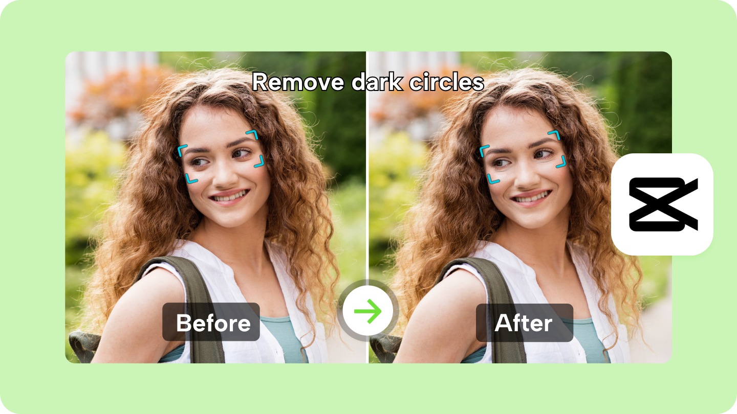 How Can I Remove Dark Circles Permanently? Fast and Effective Ways 