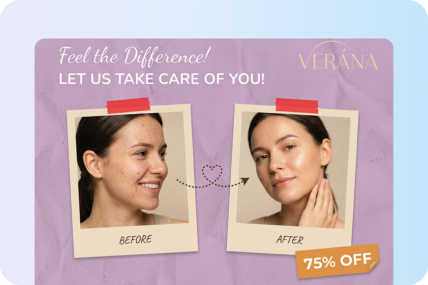 Marketing and branding