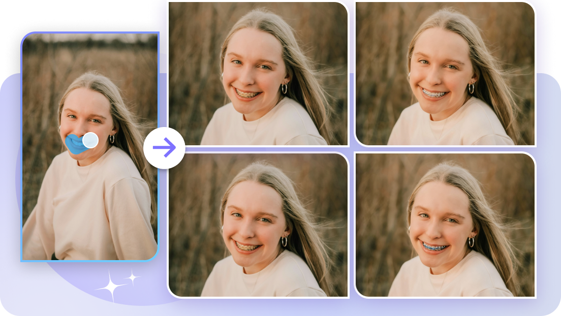 Precise teeth alignment braces filter online