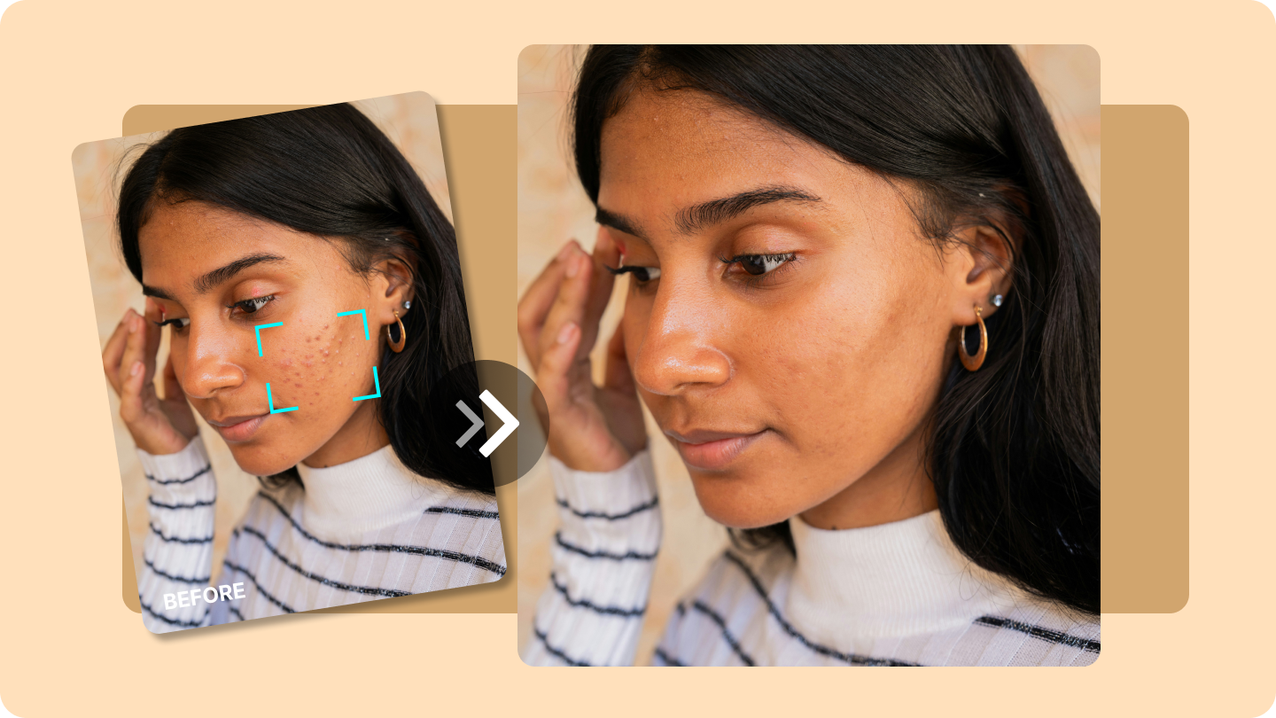  remove pimples from photo
