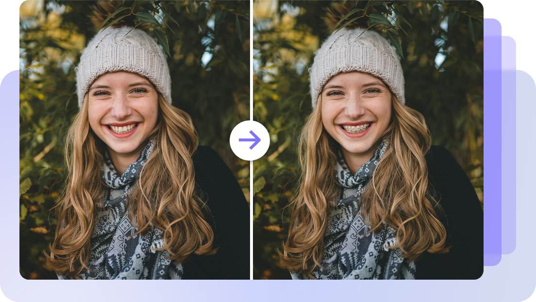  Natural smile braces try-on filter online