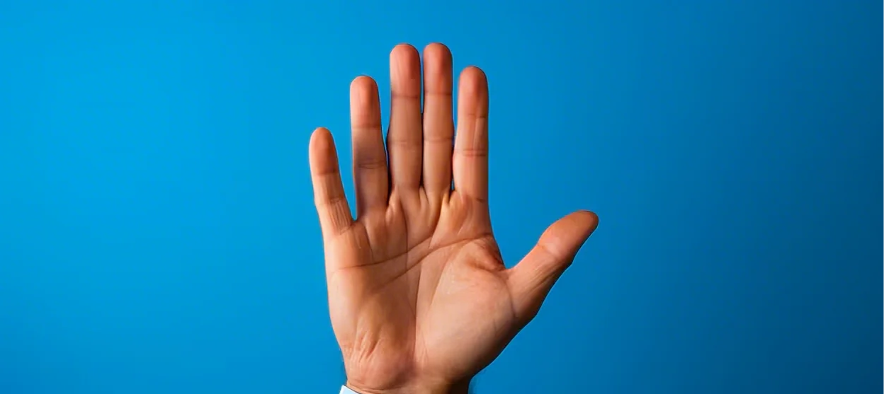 Mano con seis dedos