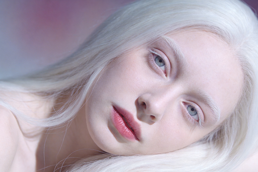 albino photo