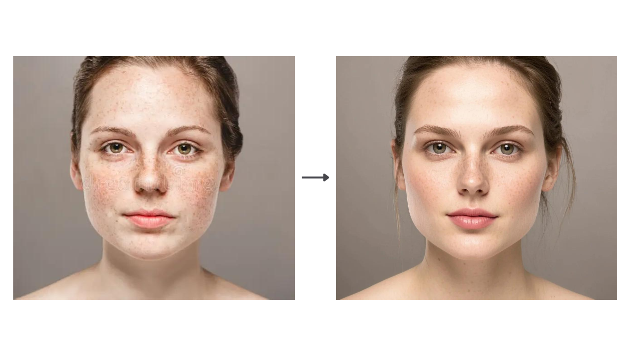 Retouch