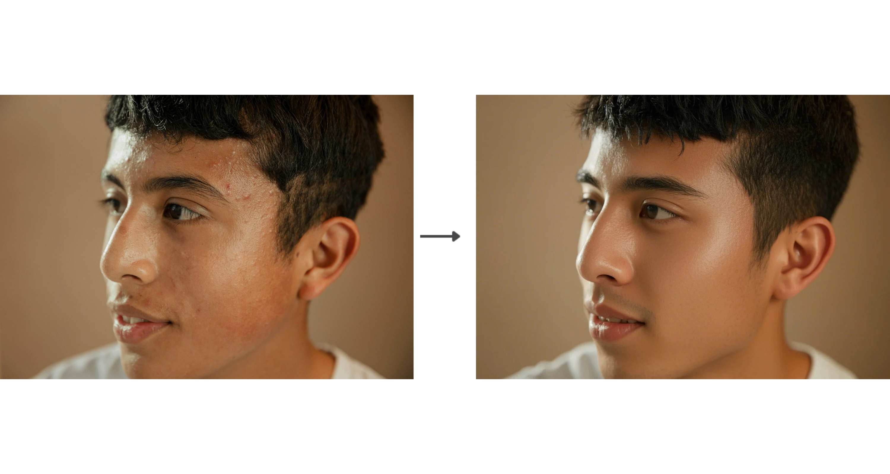 Retouch