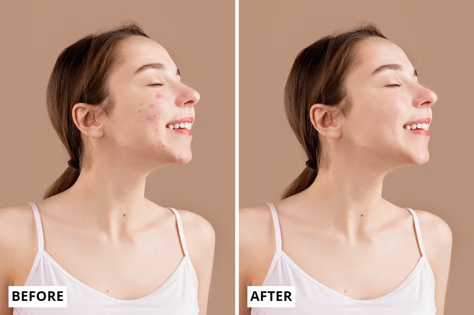 Removing blemishes and distractions