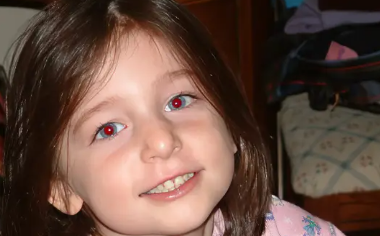 Red eyes in photos