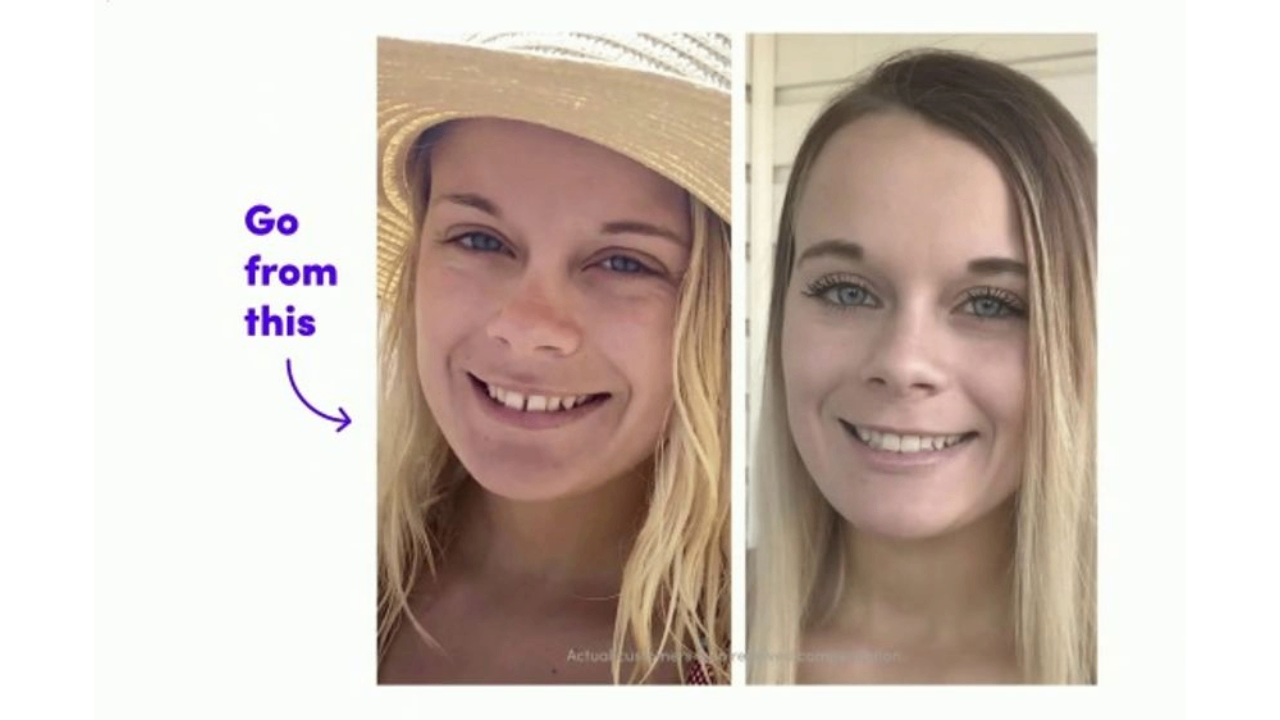 SmileDirectClub infomercial