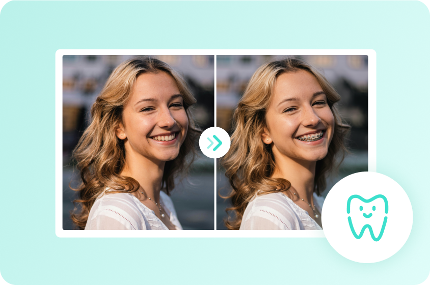  Get an instant virtual braces try-on effect in Dreamina