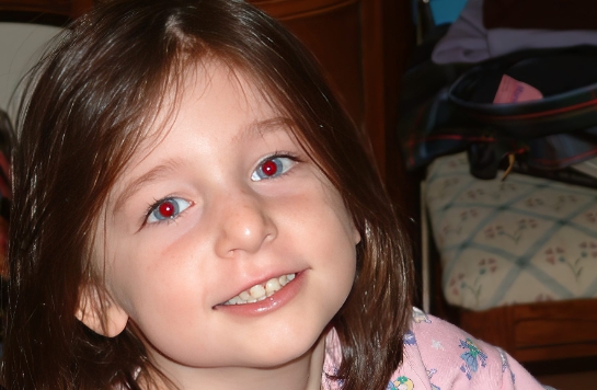 Red eyes in photos