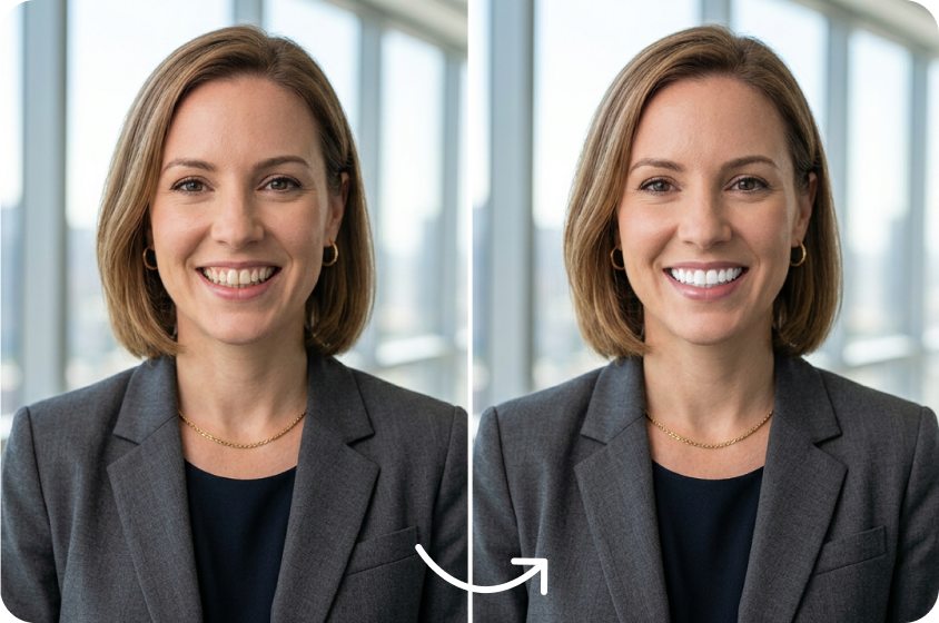 Instant automatic teeth whitening AI processing
