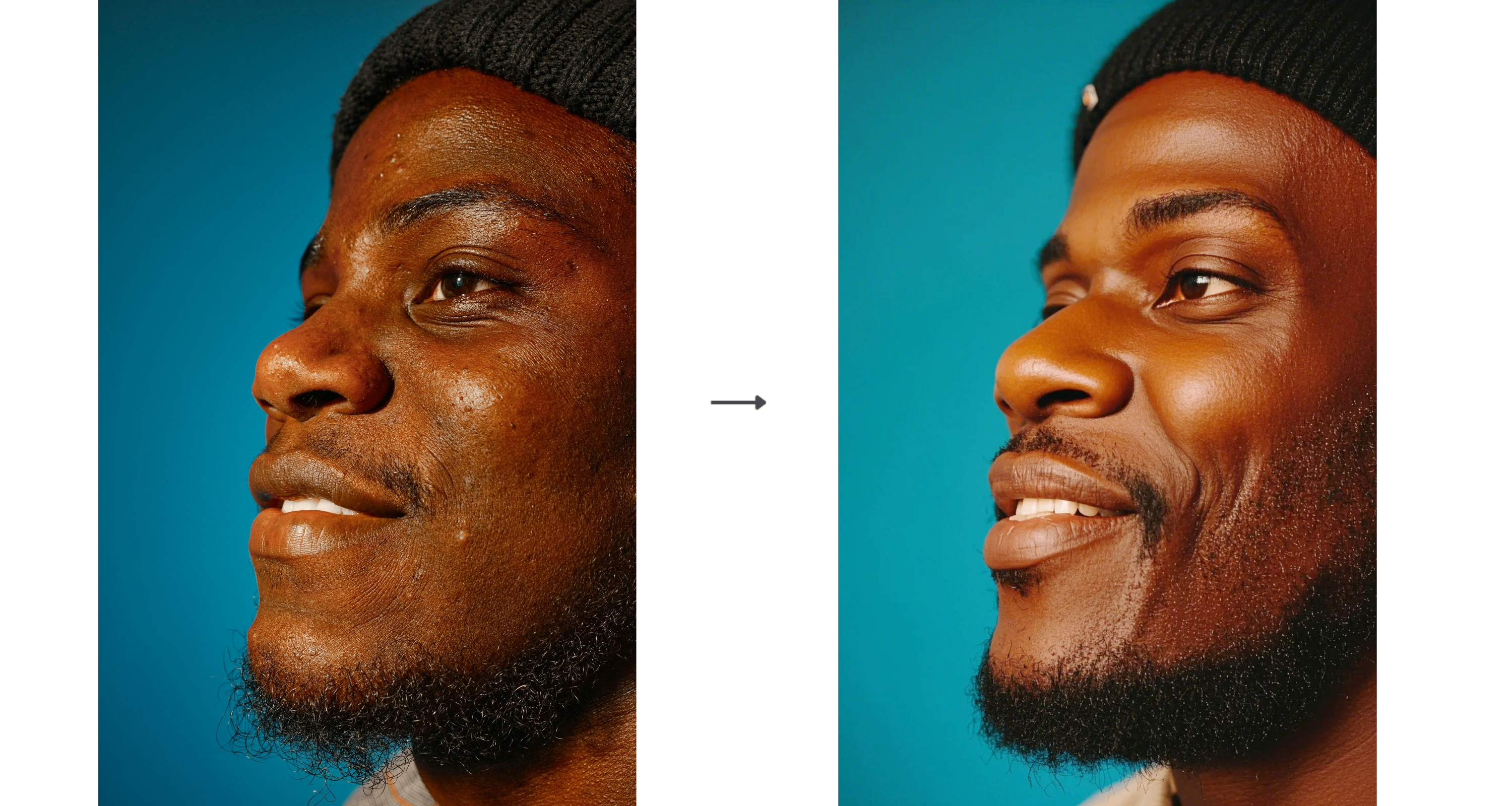 Retouch