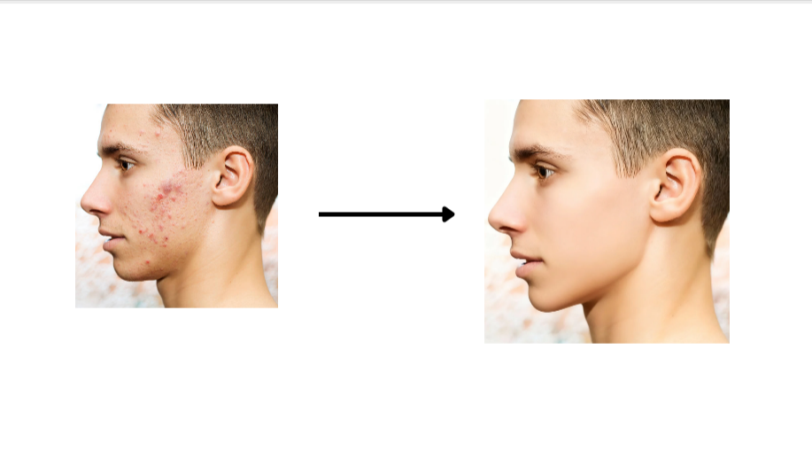 One tap retouch
