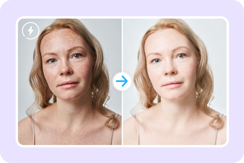 Blemishes are removed quickly in a matter of seconds