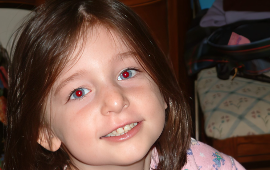 Red eyes in a photo shooting